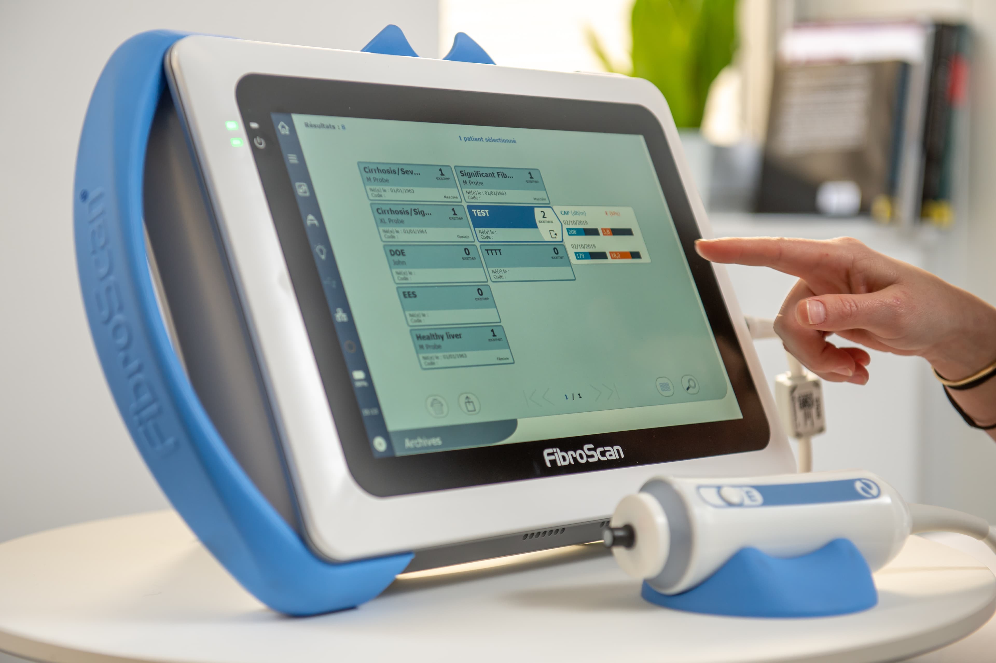 Equipo FibroScan instalado y listo para operar en un espacio clínico