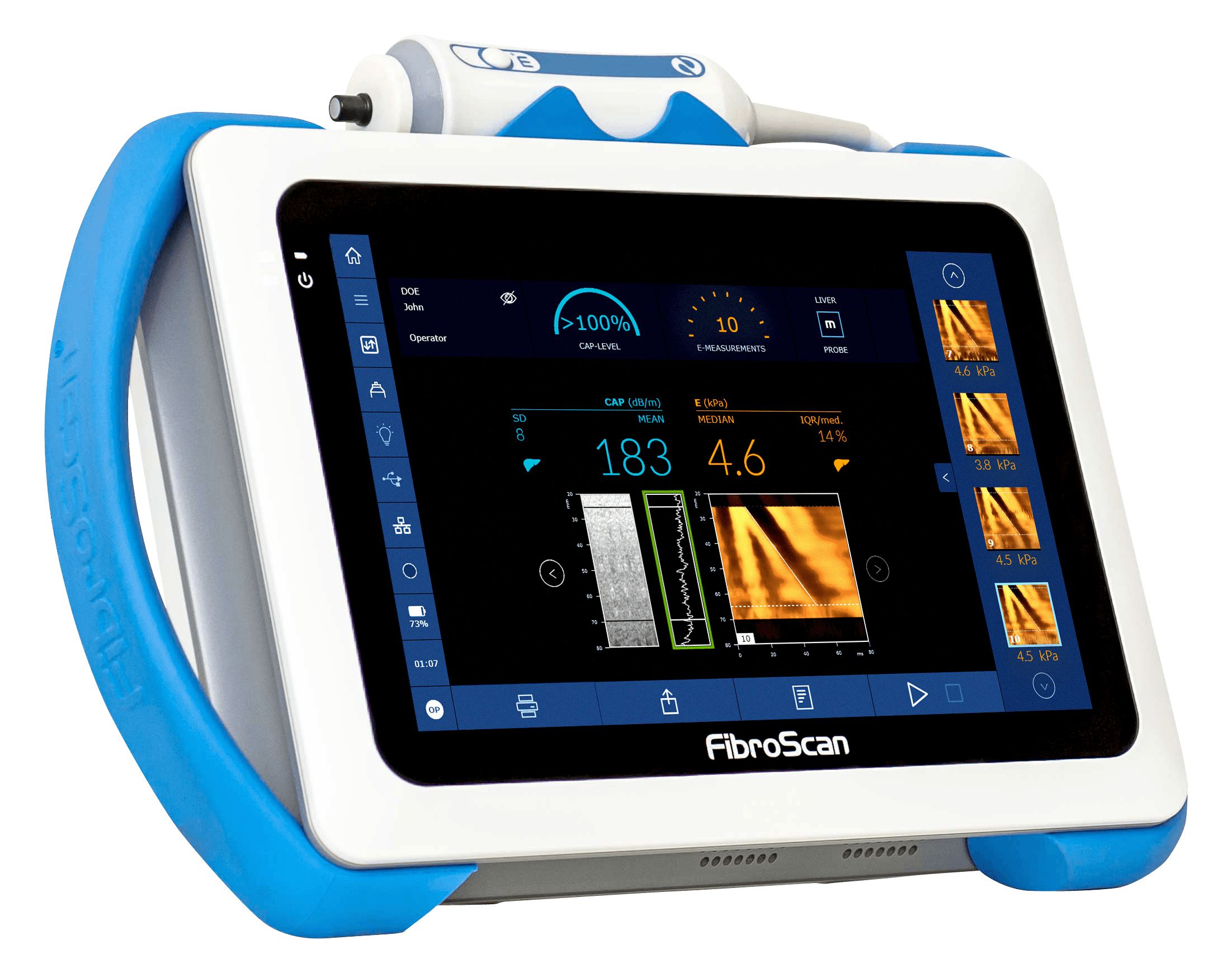 Equipo FibroScan 430 Mini+ en vista de tres cuartos