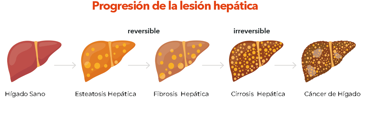Progresión de la lesión hepática...
